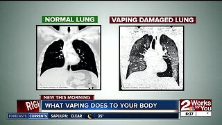 What vaping does to your body