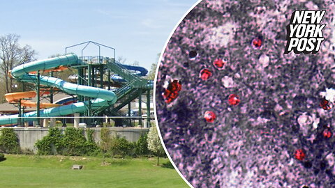 Water park pool diarrhea outbreak tied to parasite