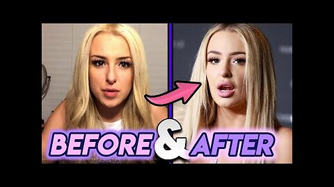 Tana Mongeau - Before and After - Plastic Surgery Transformation