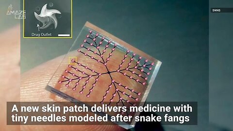 Skin patch injects medicine into human in less than 15sec, 100 invisible "snake fang" needles💉☠️💉