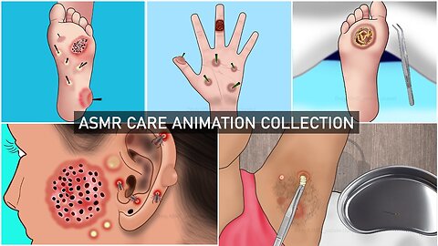 ASMR Care animation COLLECTION / foot , ear , armpit , arm