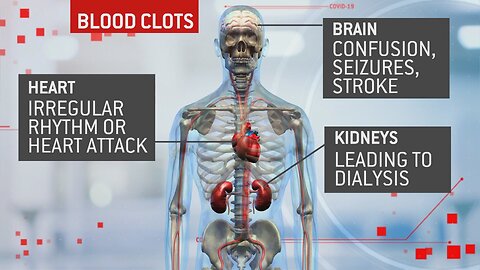 Make It Hard To Talk? Die From Covid Blood Clot Shots