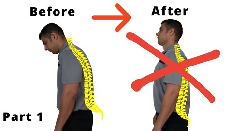 posture correction exercises