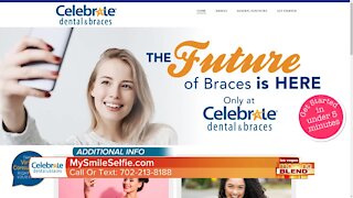 Affordable Braces Worth Smiling About