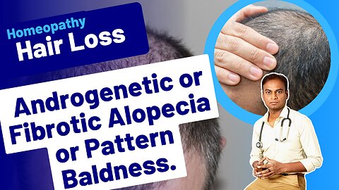 Pattern Baldness Homeopathy Treatment . Dr. Bharadwaz | Homeopathy, Medicine & Surgery