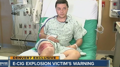 Denver man has warning for others after e-cigarette battery explodes in pocket