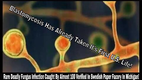 Rare Deadly Fungus Infection Caught By Almost 100 Verified In Swedish Paper Facory In Michigan!