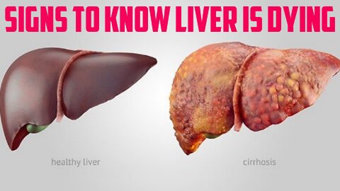 Discover your early liver damaged symptom and take actions before it gets too late