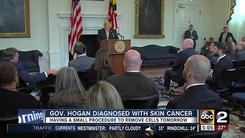 Governor Hogan announces he's being treated for skin cancer