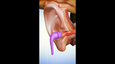 How Hearing Works 🤨 // effect earphones our hear