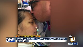 Woman defying grim prognosis after scooter accident