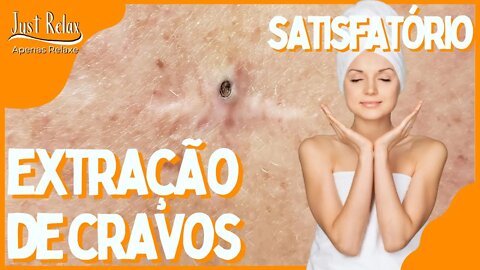 Só Relaxe Remoção de Cravos - Remove Blackheads and Pimples - Just Relax | Apenas Relaxe