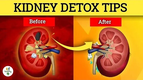 5 Ways to Detox and Cleanse your Kidneys Naturally