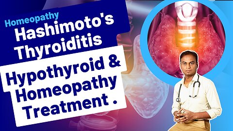 Hypothyroid and Homeopathy Treatment . | Dr. Bharadwaz | Homeopathy, Medicine & Surgery