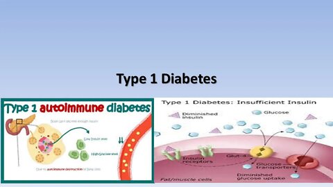 Diabetes type 1 and spiritual implications