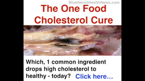 High Cholesterol