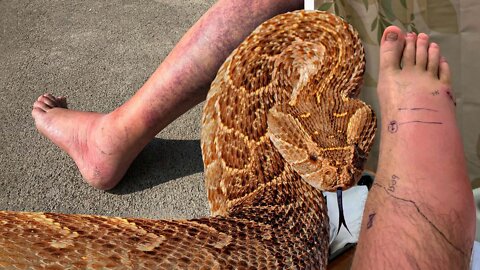 How to Survive the Most Dangerous Snake Bites