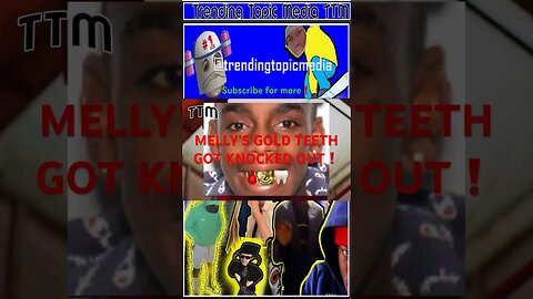 YNW MELLY’S TEETH KNOCKED OUT❗️🦷🐍💥 : TTM REPORT #ynwmelly #ynwbortlen #ynwmellytrial #shorts