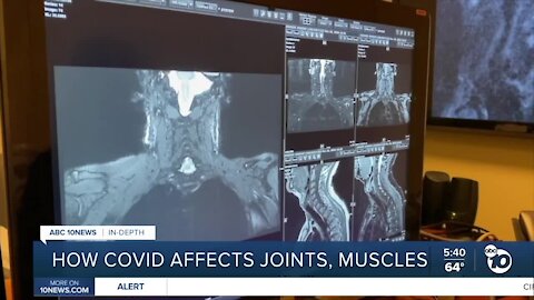 In-Depth: How COVID-19 affects joints, muscles