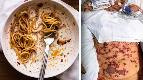 19-Year-Old Loses His Legs After Eating Leftover Takeout Food