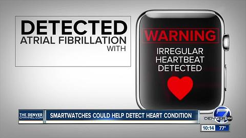 Study: Apple Watch may help doctors spot heart condition