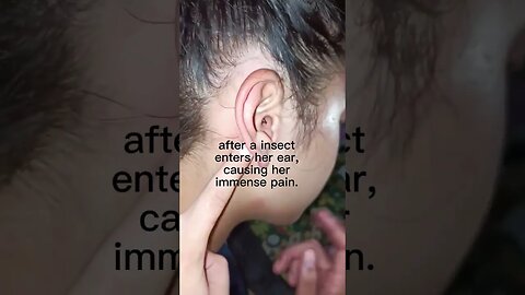 Cockroach Horror: Girl from Bohol Gets Unwanted Visitor in Her Ear #viral #shorts #shortvideo #short