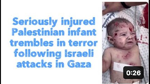 Seriously injured Palestinian infant trembles in terror following Israeli attacks in Gaza