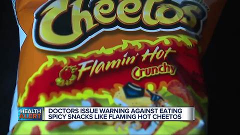 Doctors issue warning against eating spicy snacks like Flaming Hot Cheetos