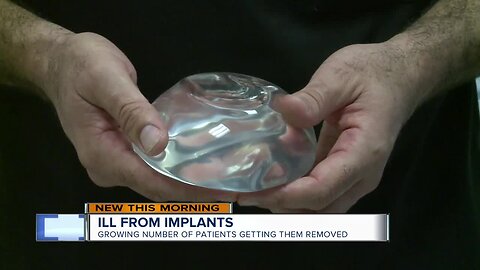 Ill from implants: growing number of patients getting them removed