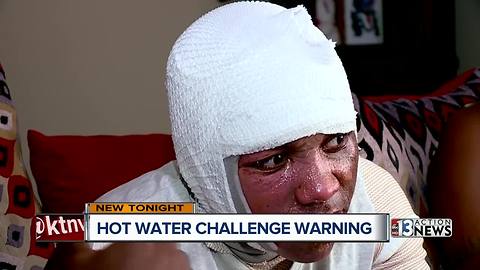 Las Vegas doctor sounds alarm about 'hot water challenge'