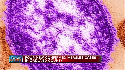 4 additional cases of measles confirmed in Oakland County