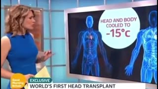 World First Head Transplant