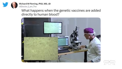 Thermographic Imaging Shows Massive Blood Clots in the Asymptomatic Vaxxed