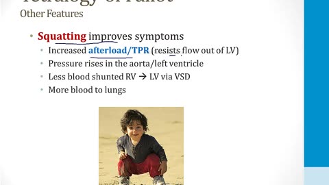 Cardiology - 7. The Developing Heart - 3.Cyanotic Congenital Heart Disease