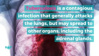 Causes Of Adrenal Insufficiency