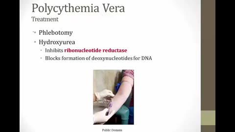 Myeloproliferative disorder bnb video