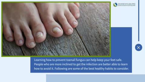 Preventing Toenail Fungus- Healthy Habits to Adopt