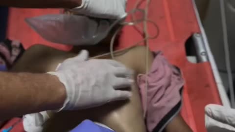 Medical teams attempt to save the life of a Palestinian child