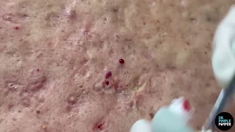 The Blackheads Paradise