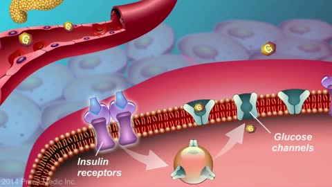 Understanding Type 2 Diabetes