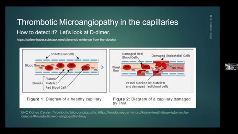 3-Cardiomyocyte exhaustion