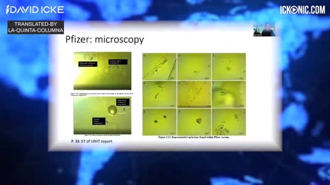 David Icke: La mente colmena de grafeno y la conexión de la vacuna falsa con la 'nube.
