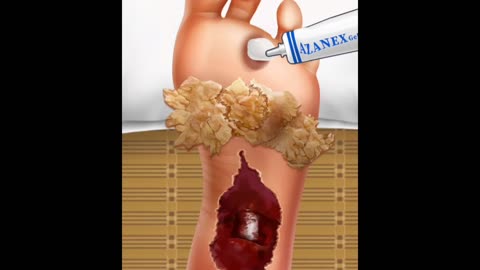 ASMR,Animation of foot repair and removal of excess skin