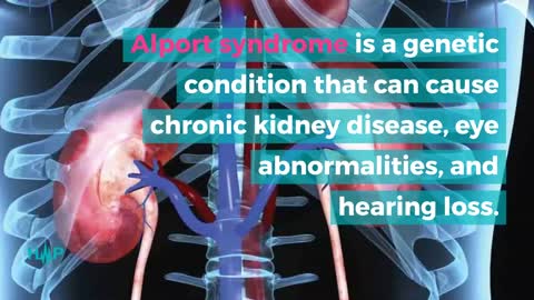 Treatment Options For Alport Syndrome