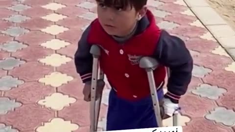 ** #Allah 🤲😭 | #FreePalestine🇵🇸**No leg to walk