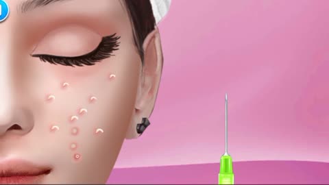 Watch Acne Disappear: A Satisfying Animation of Clearing Your Skin" #asmr #how #lip #makeup #odly