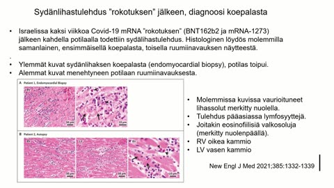 ON AIKA PUHUA - Koronarokotehaitta konferenssi - Helsinki 9.6.2023 OSA 1/2