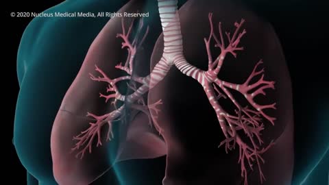 COVID-19 Animation: What Happens If You Get Coronavirus?