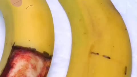 banana skin surgery need //one follow please