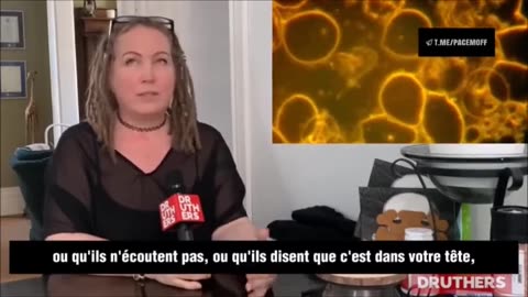 Blood analyst explains the anomalies and bizarre things she has seen in vaccinated blood…1